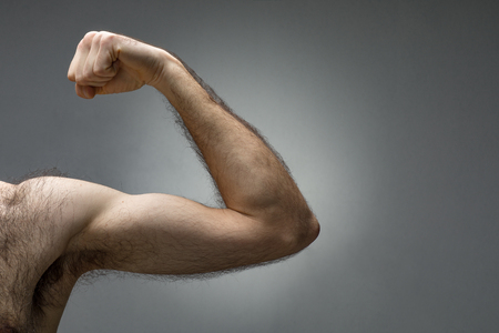 Depilação a laser masculina — Braço Completo
